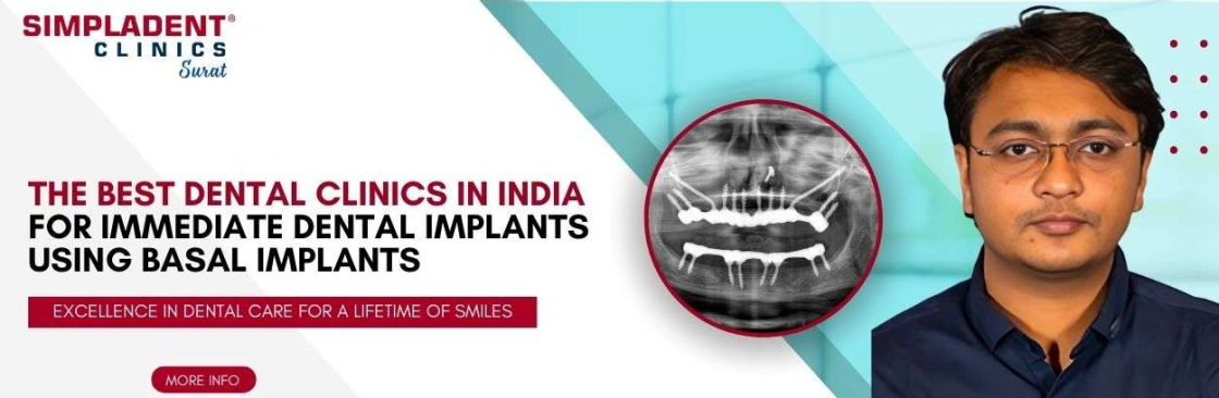 Full Mouth Dental Implant in Surat Cover Image