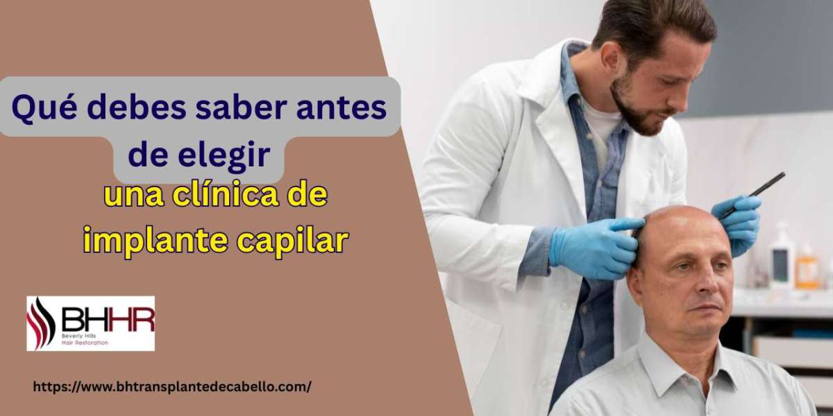 Qué debes saber antes de elegir una clínica de implante capilar