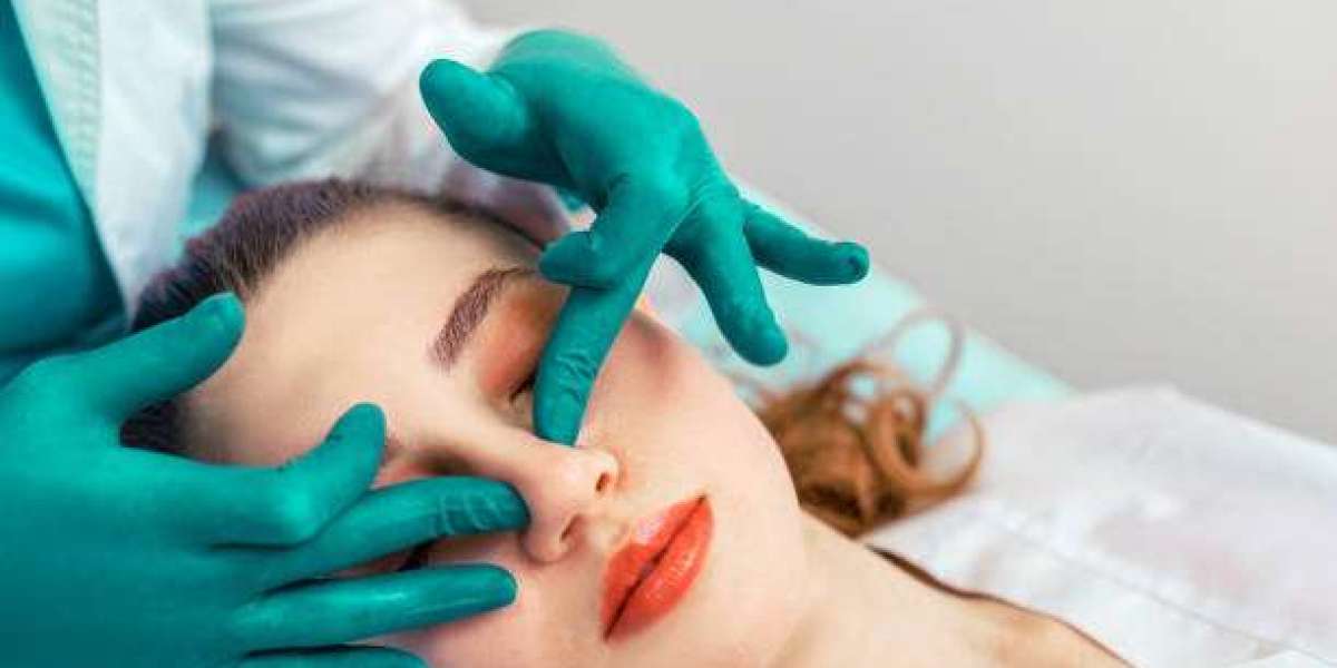 Rhinoplasty for Correcting Nose Shape and Function