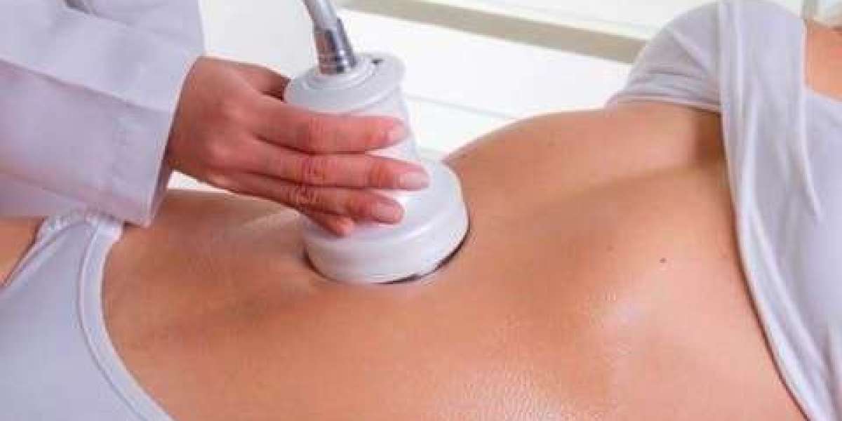 Personalized Laser Fat Reduction Treatments at Royal Clinic