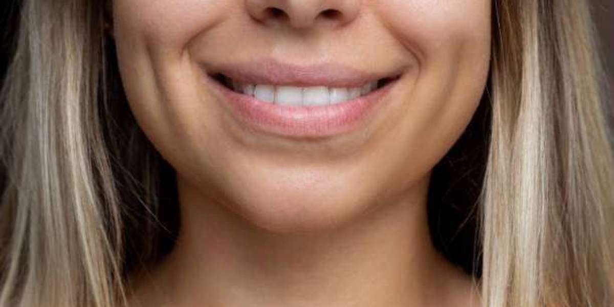 الغمازة الجراحية مقابل الطرق المؤقتة: أيهما يدوم أكثر؟