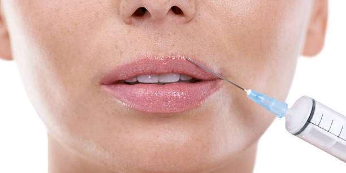 Confidence Gains From Russian Lip Fillers Results