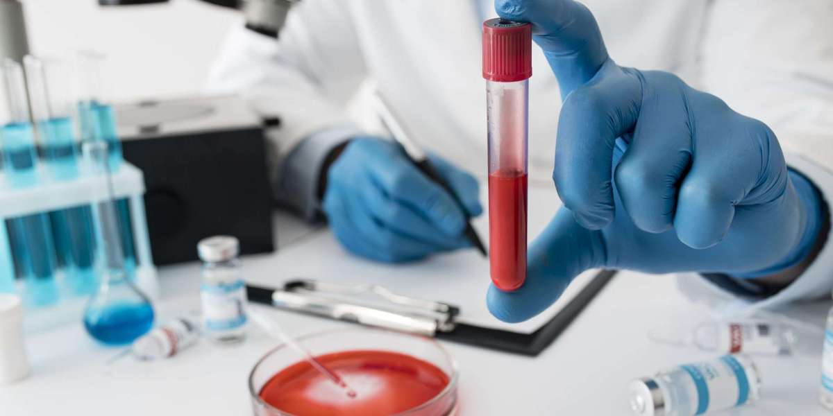 Home Blood Tests in Bangalore: Your Complete Guide to Convenient Health Monitoring