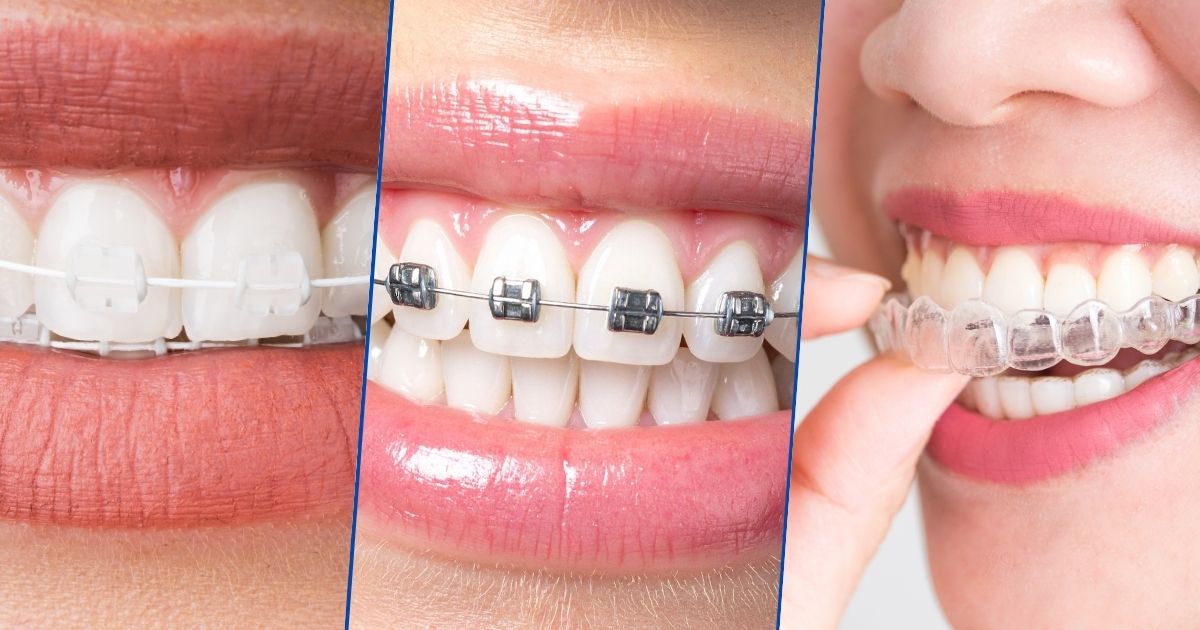 Best Orthodontics In Kolkata - Metal, Ceramic & Clear Aligners | TCMDC