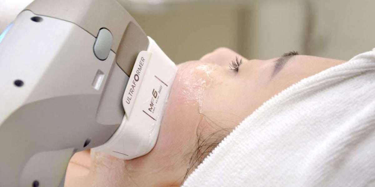 How Long Does HIFU Last? What to Expect After Your First Session