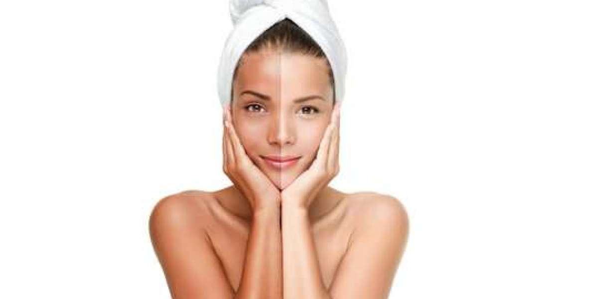 تبييض البشرة بميزانية معقولة: نصائح لاقتناص أفضل عروض دبي