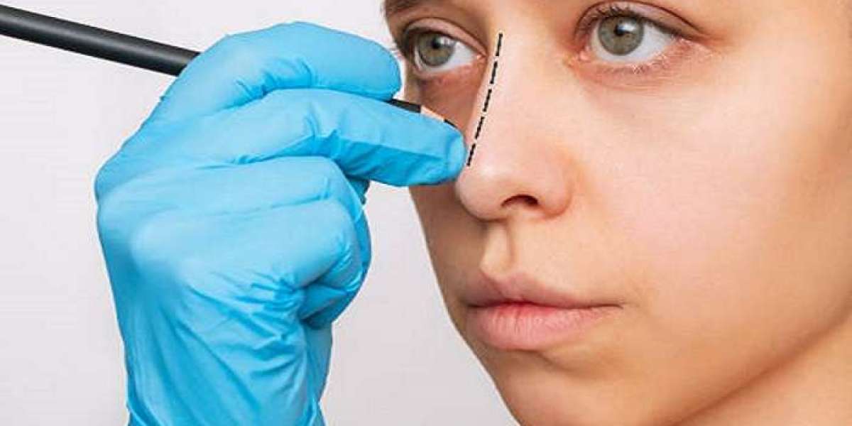 The Reveal: Why Rhinoplasty is Riyadh’s Most Searched Procedure