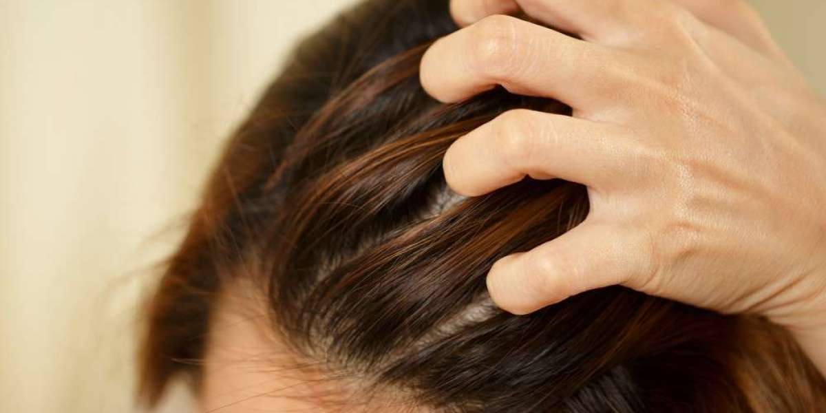 Best Anti-Dandruff and Hair Fall Control Shampoo for Healthy Hair