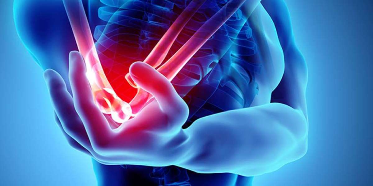 Tennis Elbow Specialist Doctor in South Delhi
