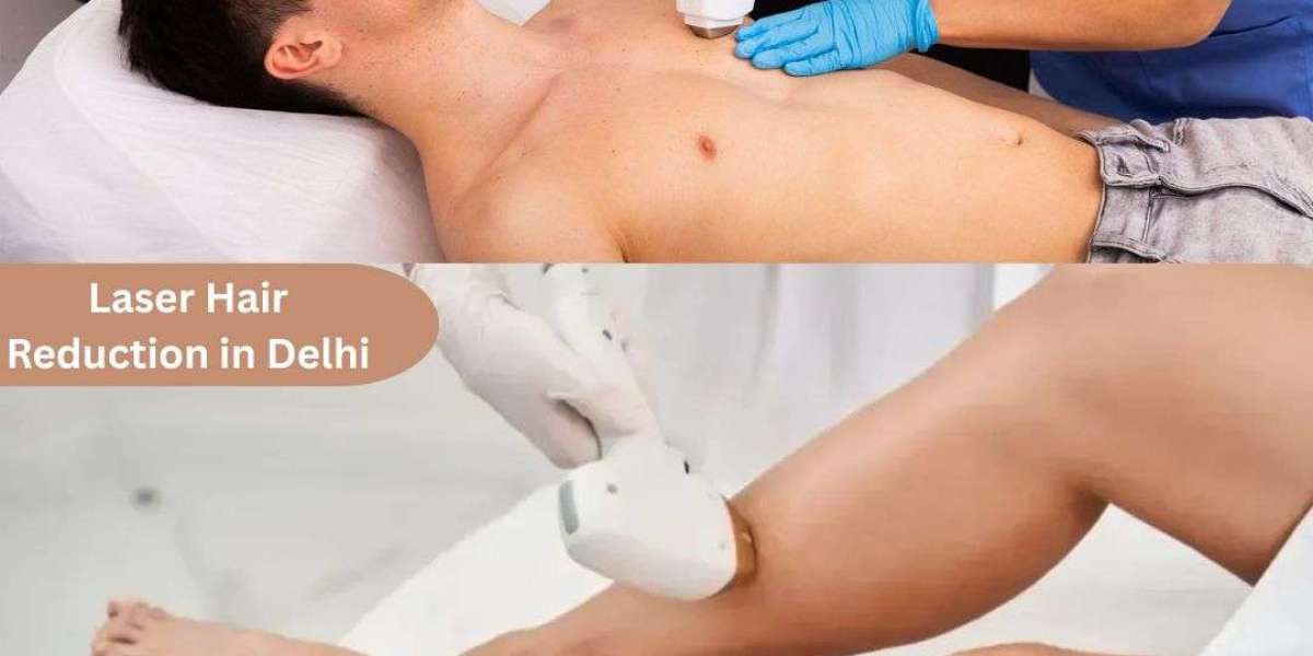 Tired of Waxing Every Month? Here Is What You Should Know About Laser Hair Reduction