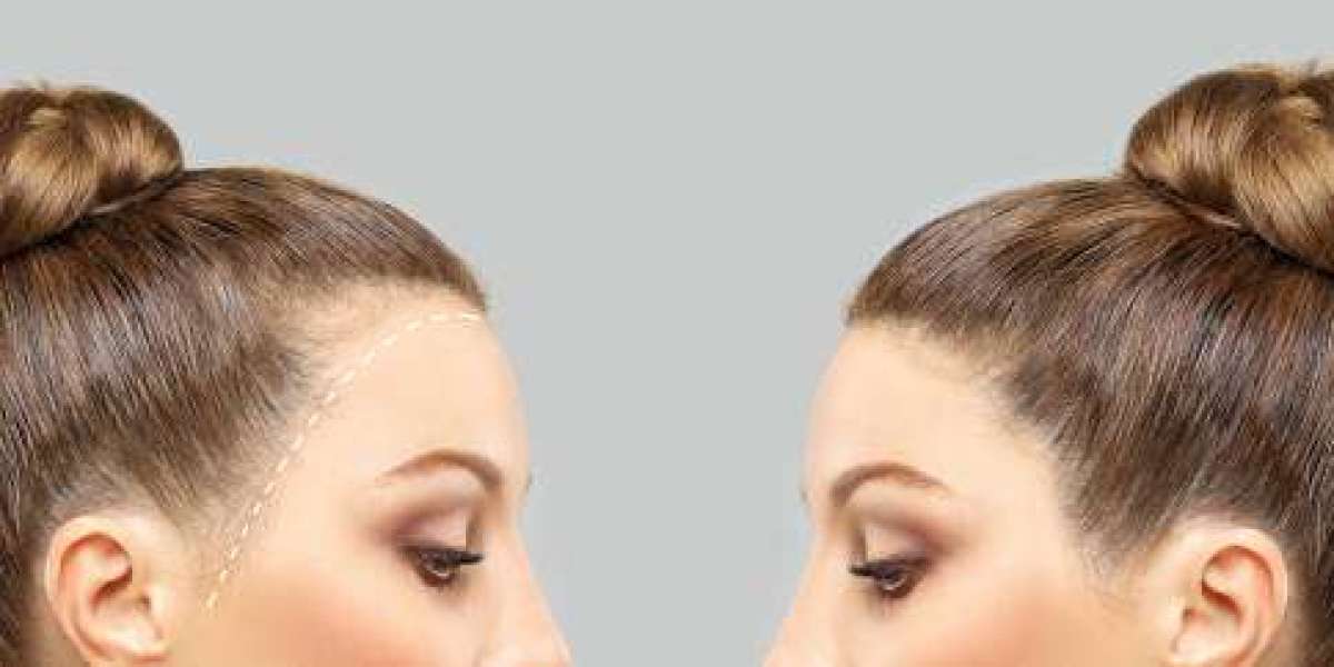 Article Picture