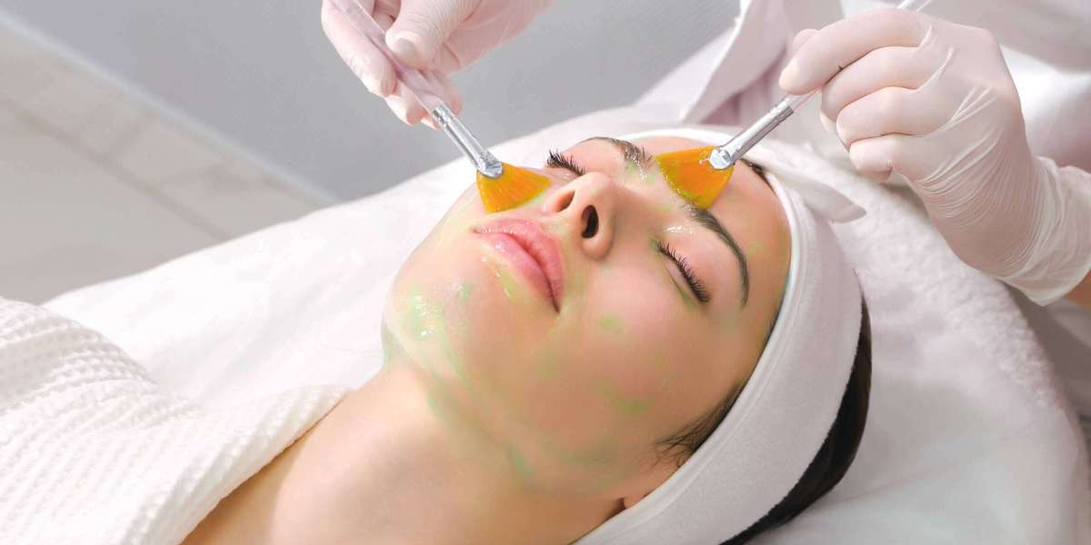 Chemical Peel Treatments For Lasting Radiance