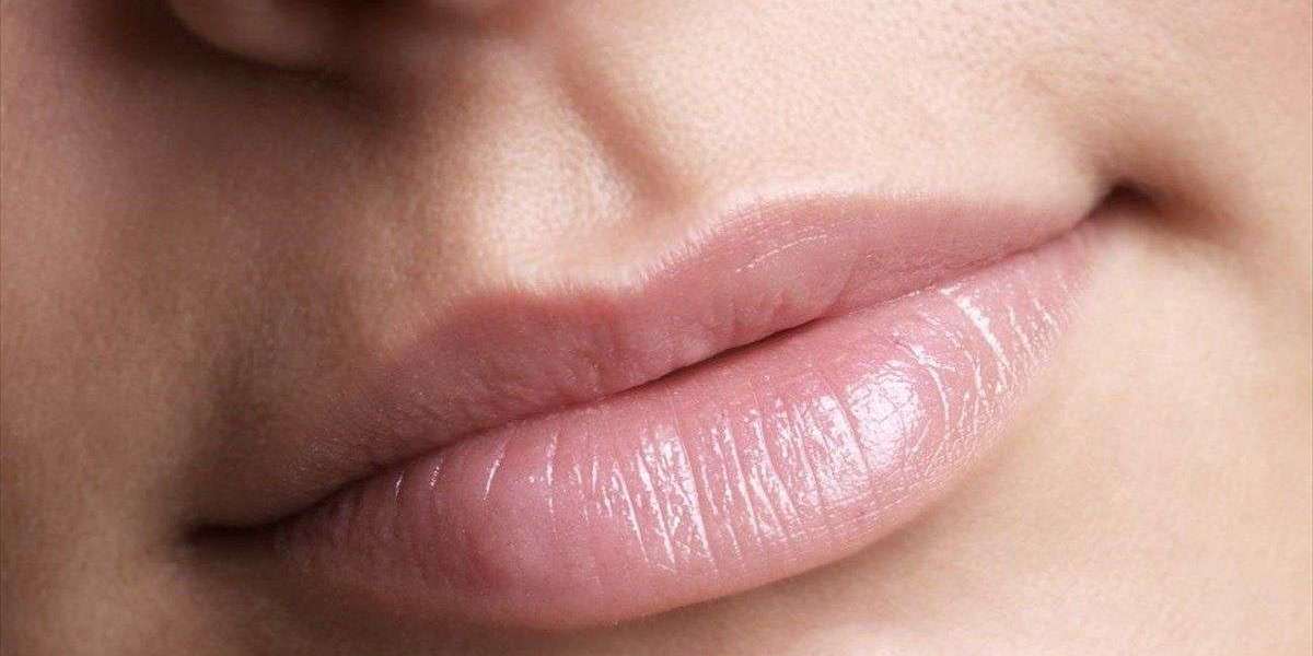 Can Lip Reduction Create a More Natural Facial Look?
