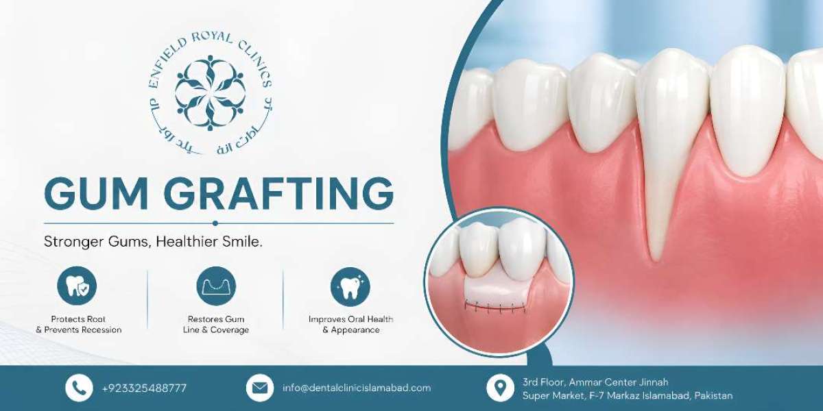 Gum Grafting in Islamabad for Complete Gum Care
