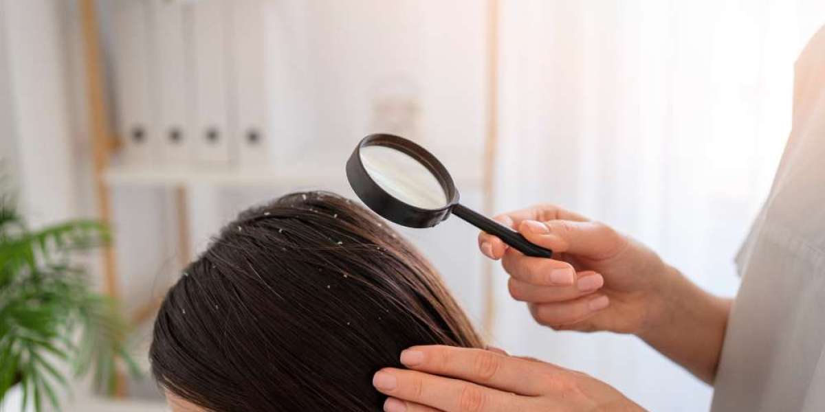 Best Anti-Dandruff Shampoo for Itchy Scalp and Stronger Hair