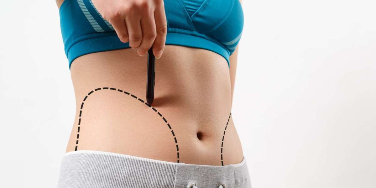 Discover Advanced Body Contouring with the Best Liposuction Surgeons in Dubai