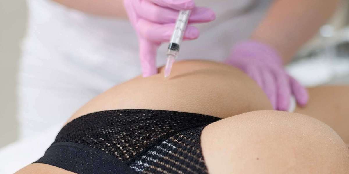 What Benefits Can You Expect From Butt Fillers?