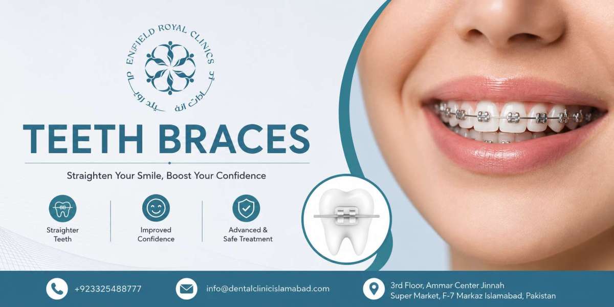 Brighten Your Smile with Teeth Braces in Islamabad