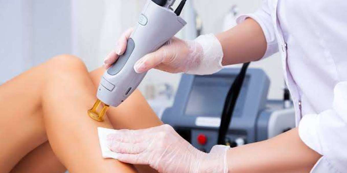 Laser Hair Removal Surrey: Understanding Treatment Costs