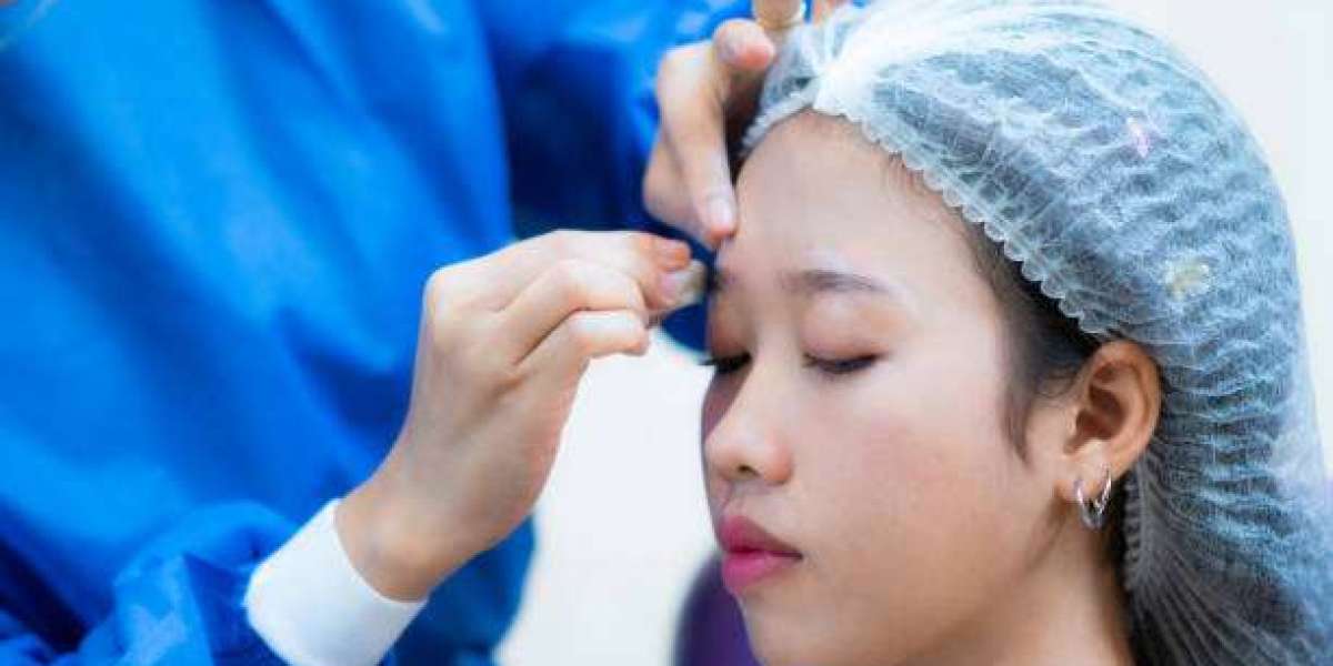 Can Eyebrow Hair Transplant in Dubai Restore Brows After Years of Plucking