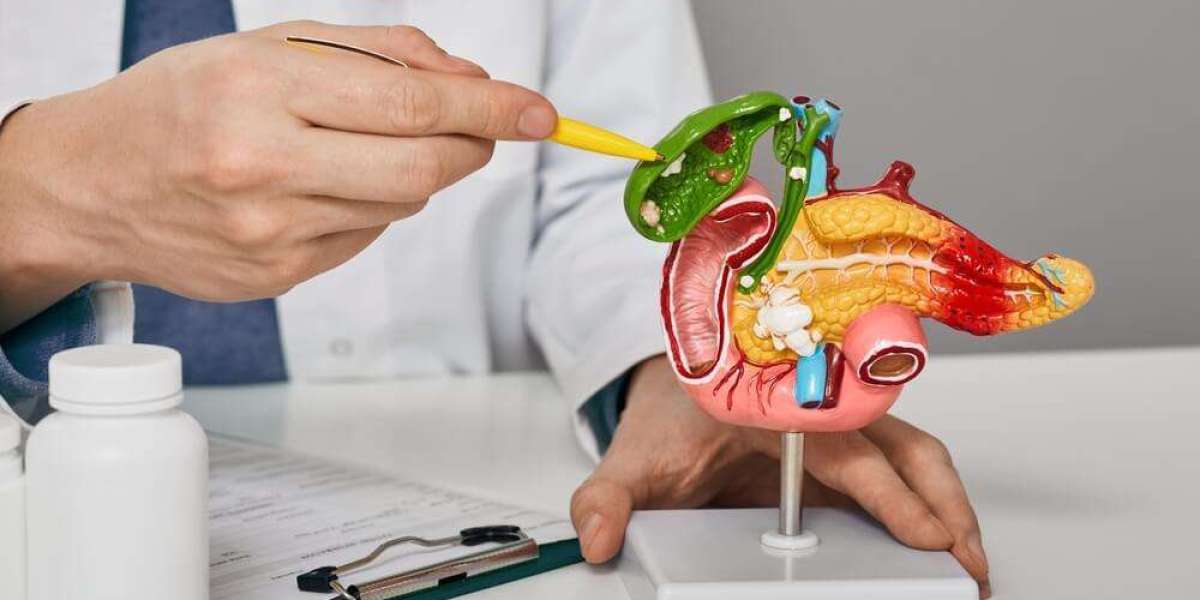 How Does Weight Affect Gallstones?